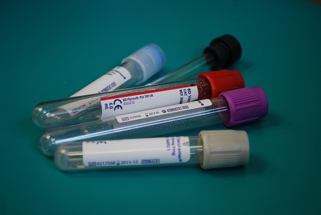 Mastering Thyroid Health: A Guide to the UK Advanced Thyroid Blood Test