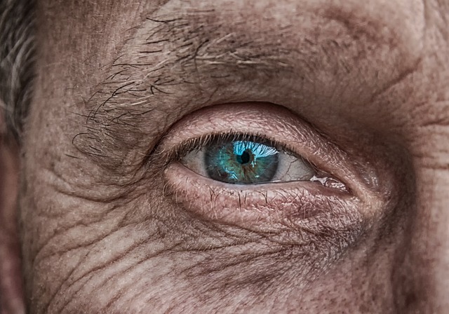 Skin Tag Removal Edinburgh: Understanding Causes and Traditional Techniques