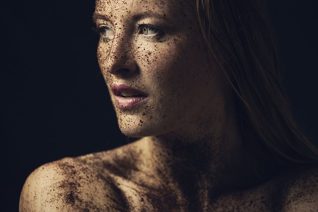 skin tag