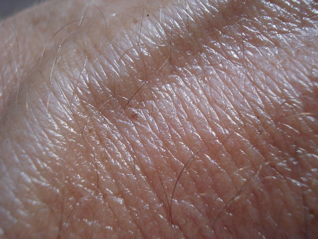 skin-tag-640x480-32856480.jpeg