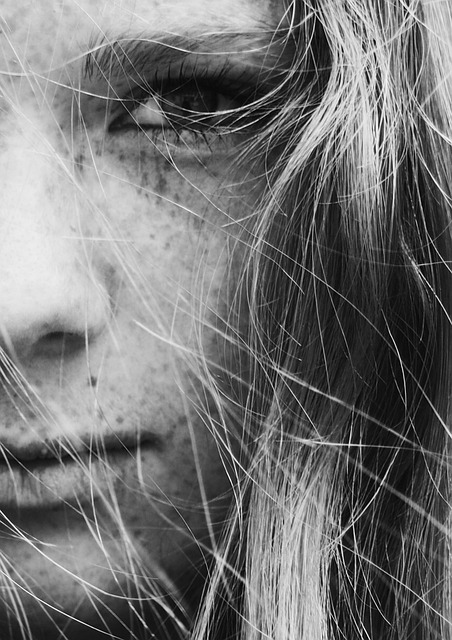 skin tag