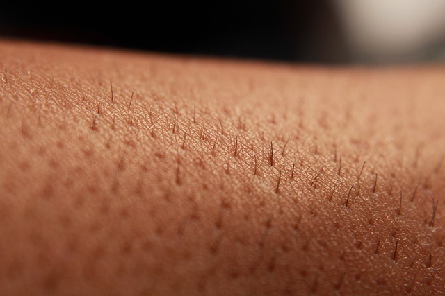 Natural Skin Tag Solutions: Safe Home Remedies for Residents of Edinburgh