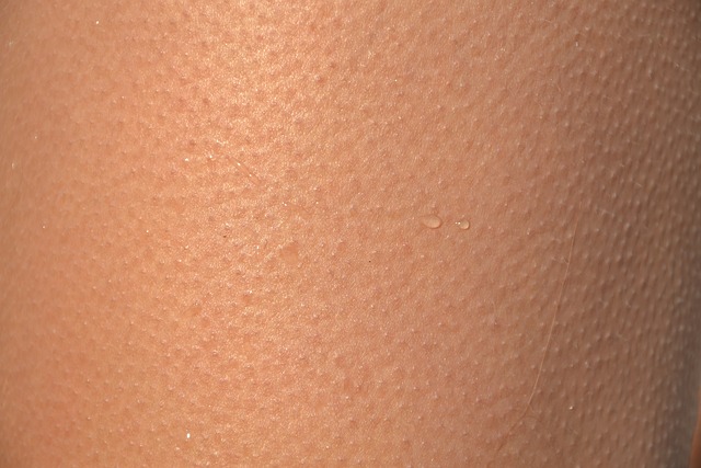 Comprehensive Guide to Effective Skin Tag Treatments in Glasgow