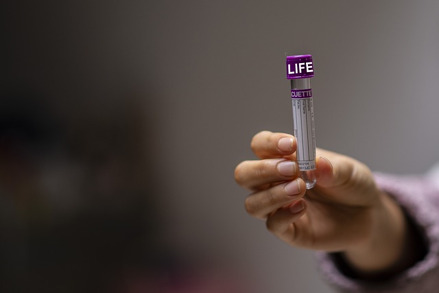 Home Health Check-ups: Enhancing Well-being with Kidney Blood Test UK
