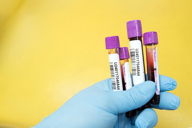 Monitor Your Health: UK Vitamin D Blood Tests at Home