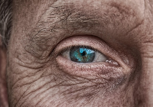 Uncovering Bristol’s Best: Benefits of Skin Tag Removal