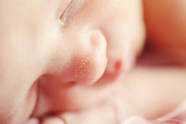 Effective Skin Tag Treatment: Methods for Arms & Legs