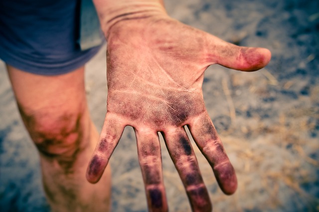 Bradford Tag Removal: Cryotherapy vs Traditional Methods