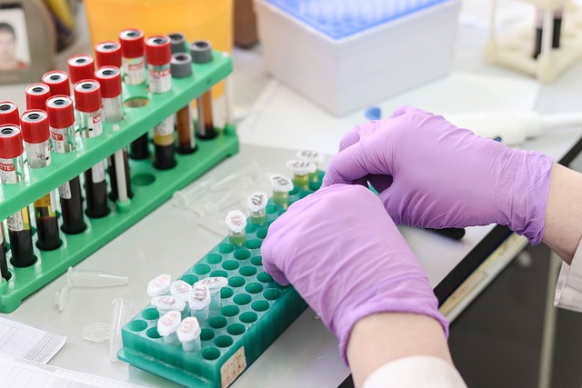 Kidney Blood Test UK: Online Access, Preparation & Result Interpretation Guide