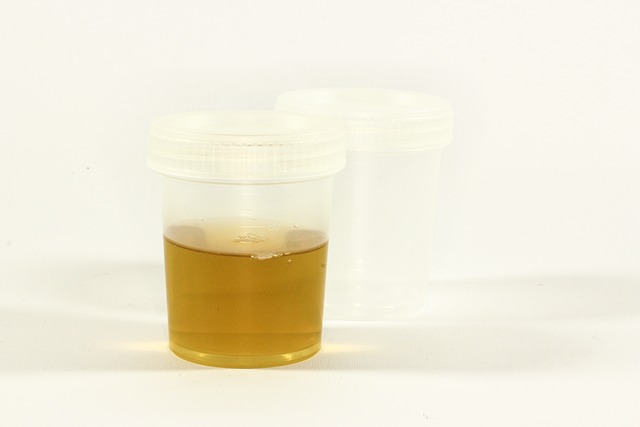 Iron Blood Test UK: Online Services Revolutionize Health Monitoring