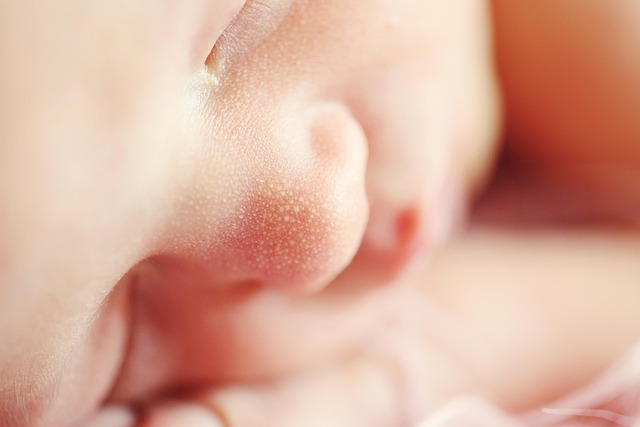 Non-Surgical Glasgow Tag Removal: Effective Home Remedies & Safety Tips