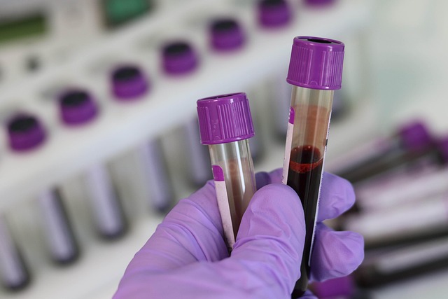 Monitor Liver Health at Home with Advanced Liver Blood Test UK