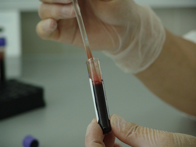 Well Person Blood Test UK: Unlocking Vitamin D’s Impact on Wellness