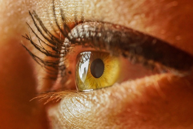 Skin Tag Risks: Why Consider Removal in Bradford