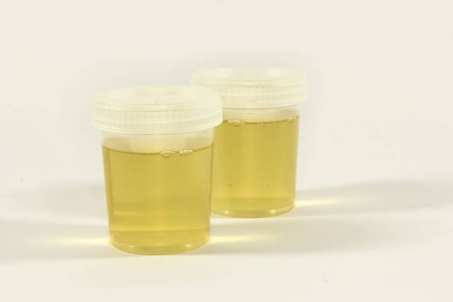 Vitamin B12 Blood Test UK: Online Monitoring for Better Health