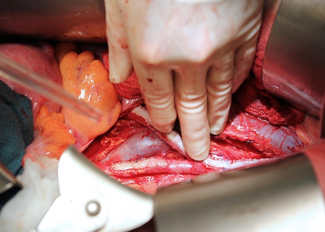 outpatient wart removal procedure