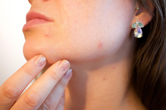 quick skin tag removal treatment