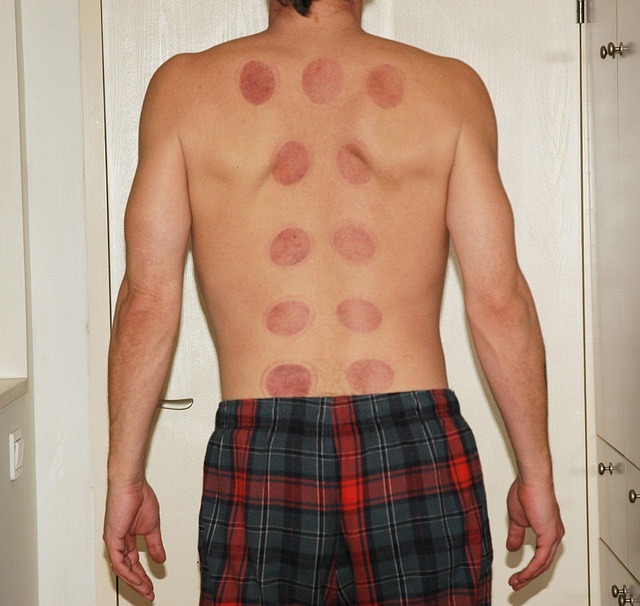 affordable skin tag removal treatment