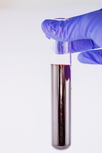 blood test