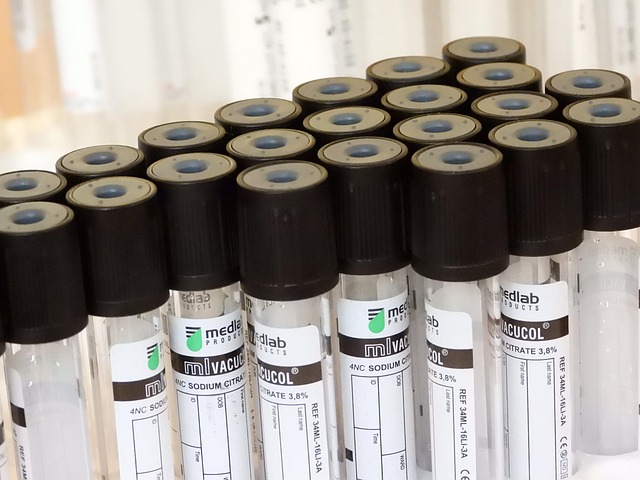 blood test