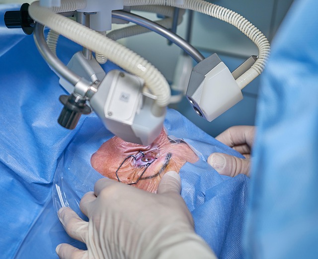 experienced wart removal surgeon