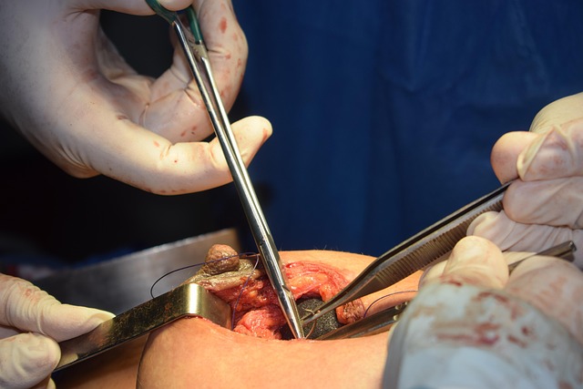 outpatient wart removal procedure