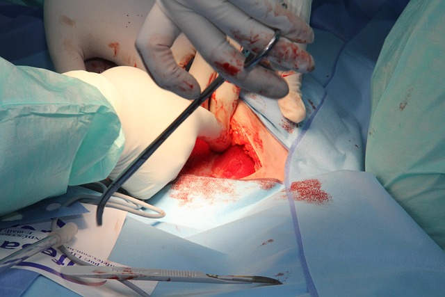 surgical wart removal procedure