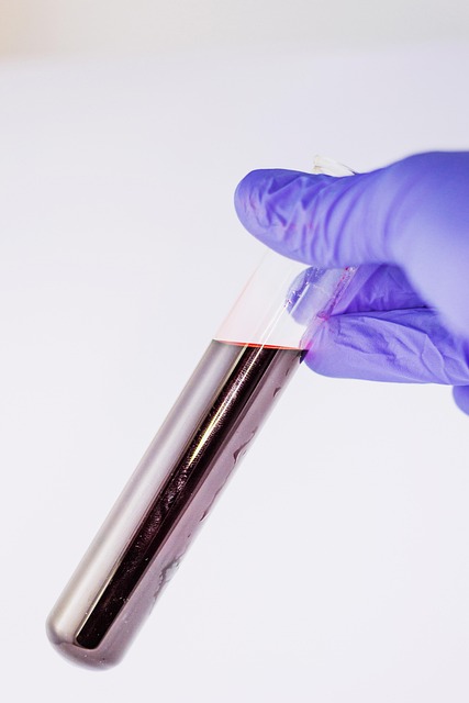 blood test