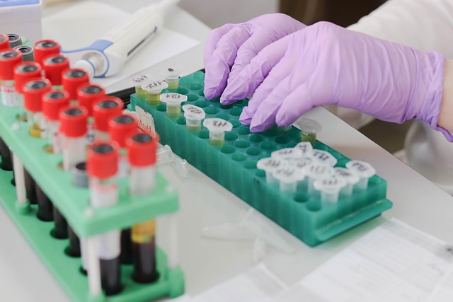 blood test