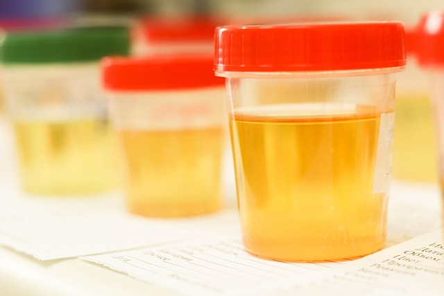 blood test