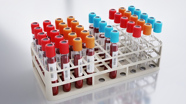 blood test