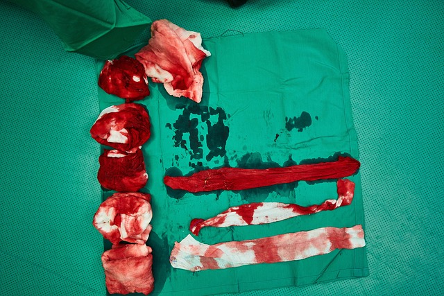 experienced wart removal surgeon