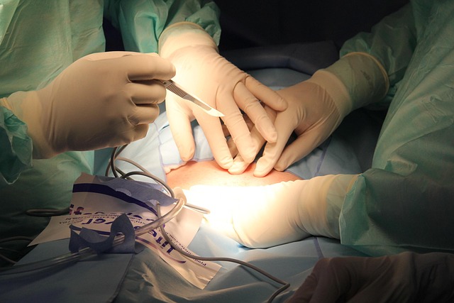 surgical wart removal procedure