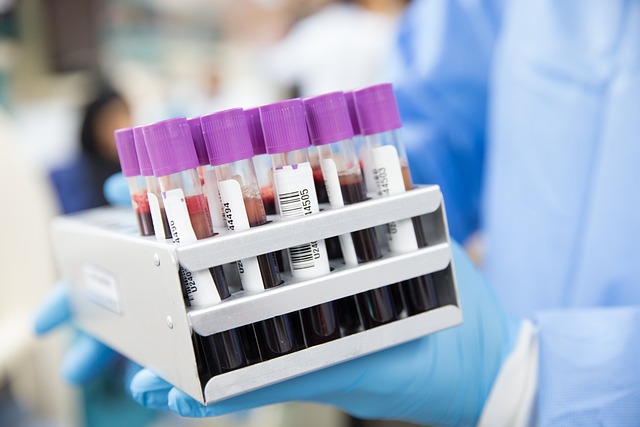 blood test