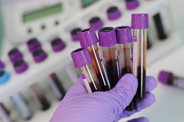 blood test