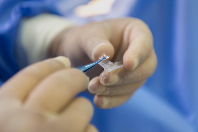professional wart removal treatment