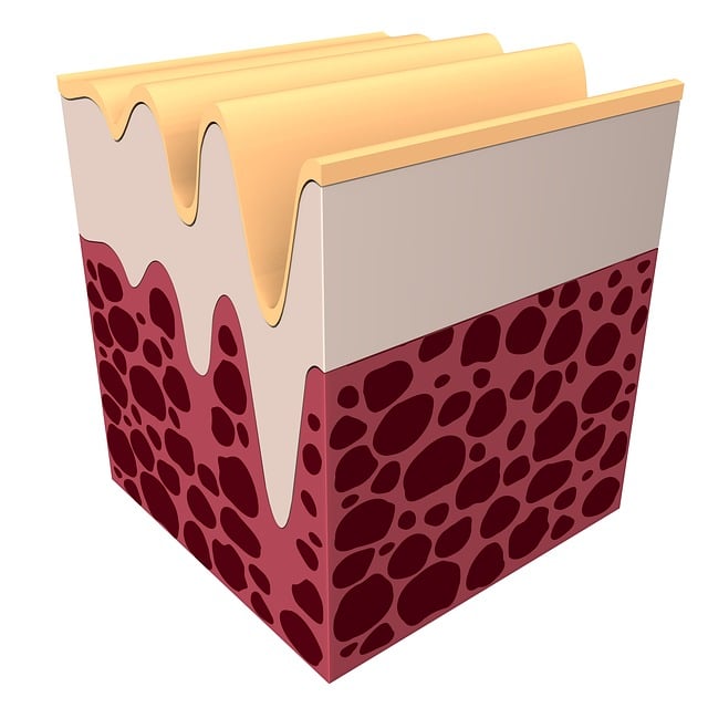 skin tag