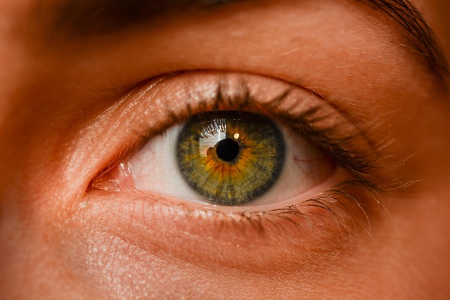 skin tag