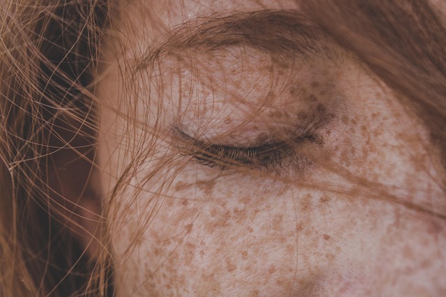 skin tag