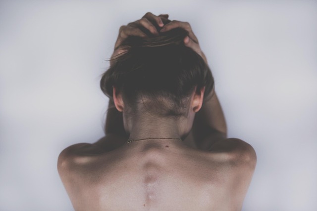skin tag