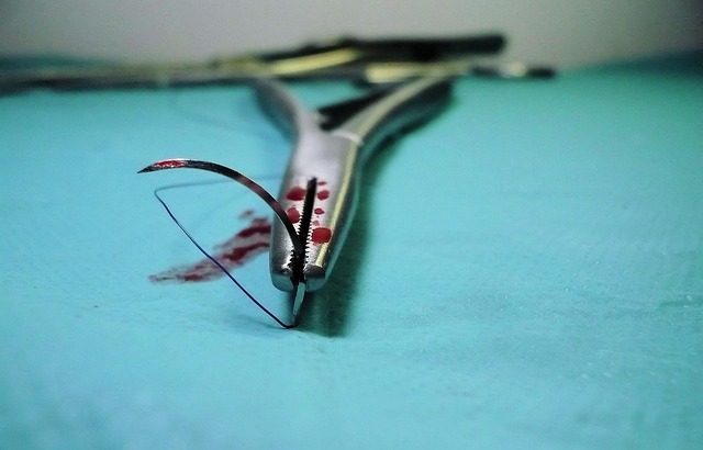 laser skin tag removal procedure