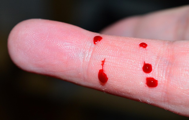 non invasive wart removal method