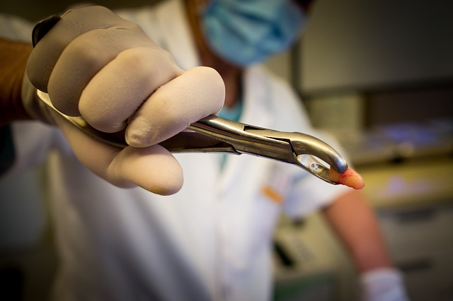 professional wart removal treatment