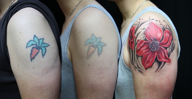laser skin tag removal procedure