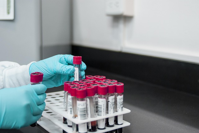 online thyroid test results