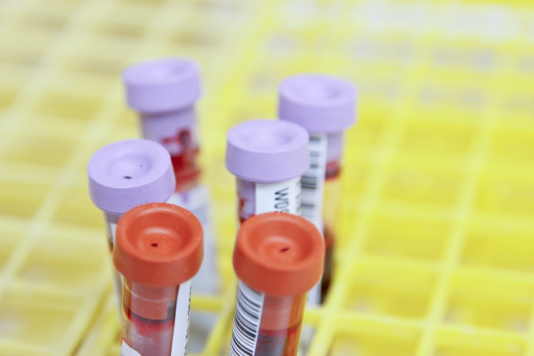 Boost Testosterone Naturally: Testing & Lifestyle Changes
