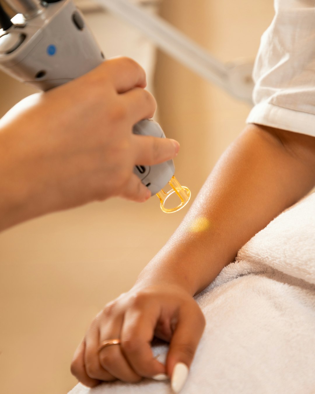 Prevent Warts: Specialized Removal Center Solutions